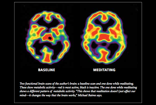 Brain changes that result from Mindfulness Training