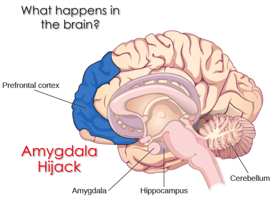 What is an Amygdala Hijack in the brain